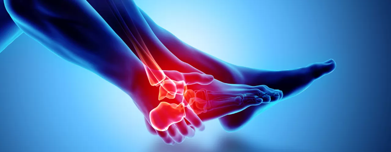 Sports Performance Bulletin - Muscles and tendons - Ankle sprains